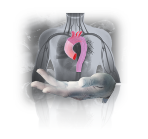 Aneurismi aortici: con il progetto europeo Pandora arriva la modellazione in-silico per assistere i chirurghi.